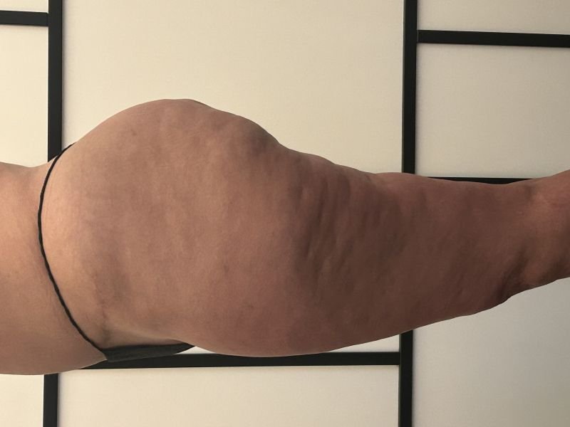 lado1.jpg