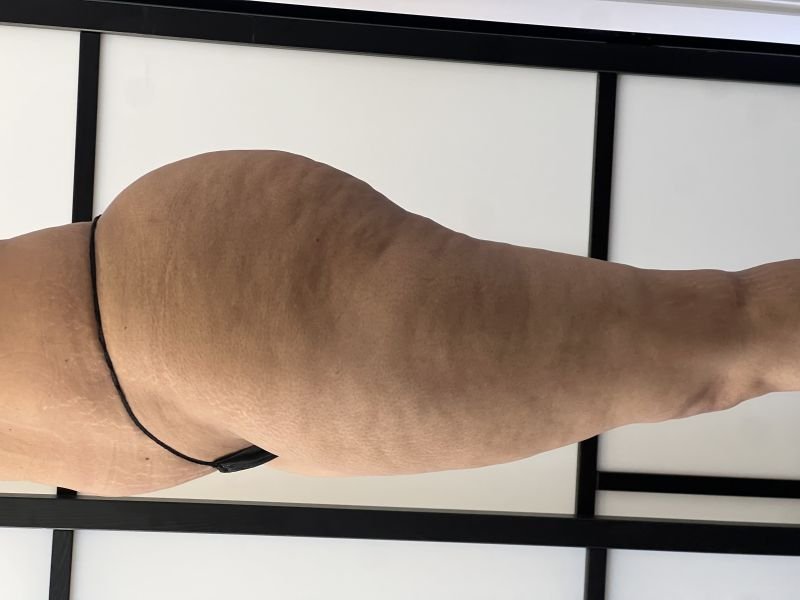 lado1.jpg