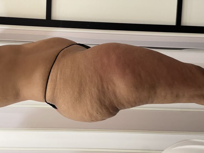 lado2.jpg