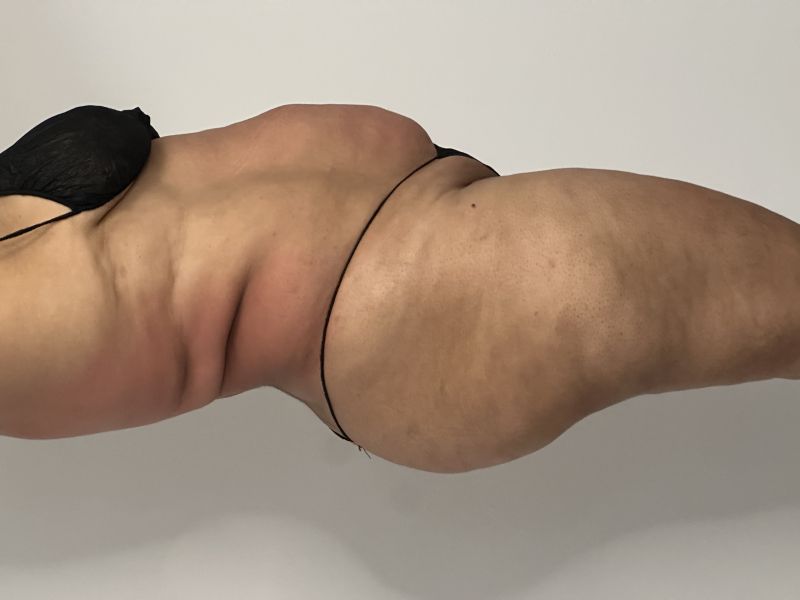 lado2.jpg
