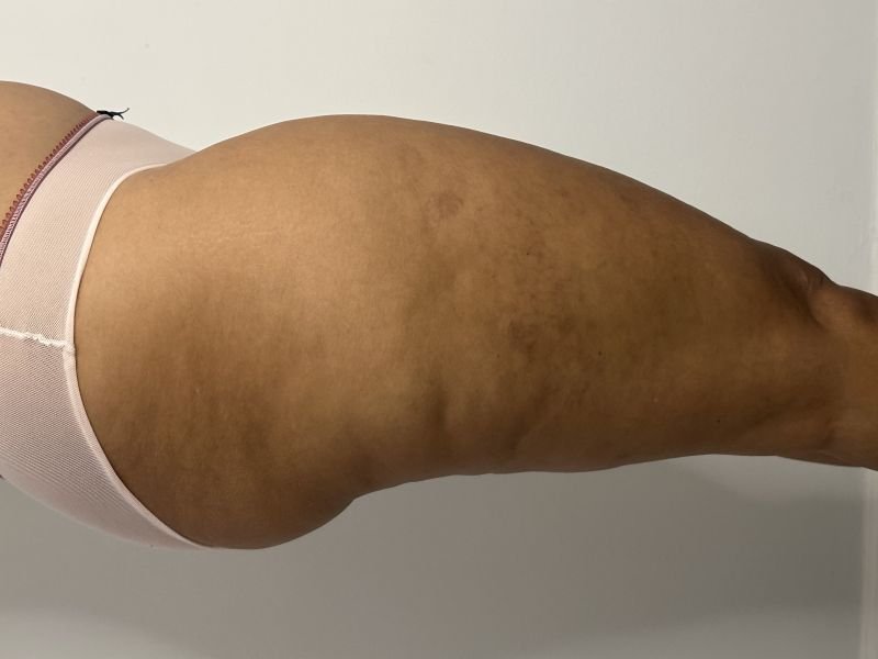 lado1.jpg