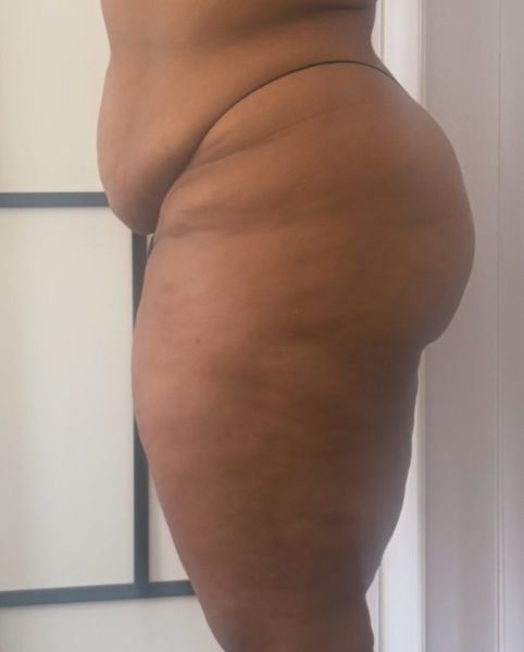 lado1.jpg