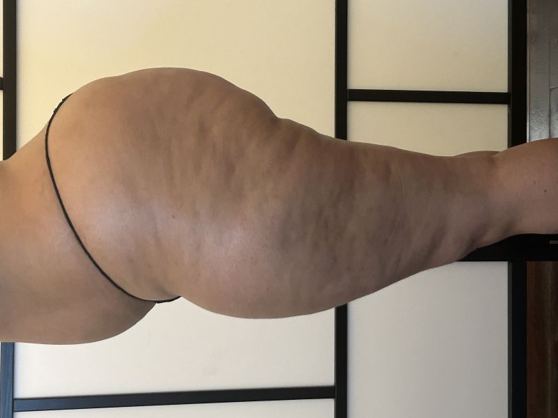 lado2.jpg