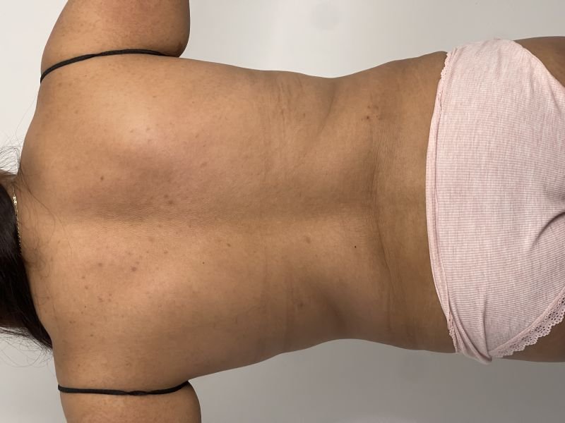 atras.jpg