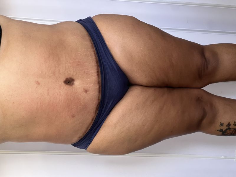 frente.jpg
